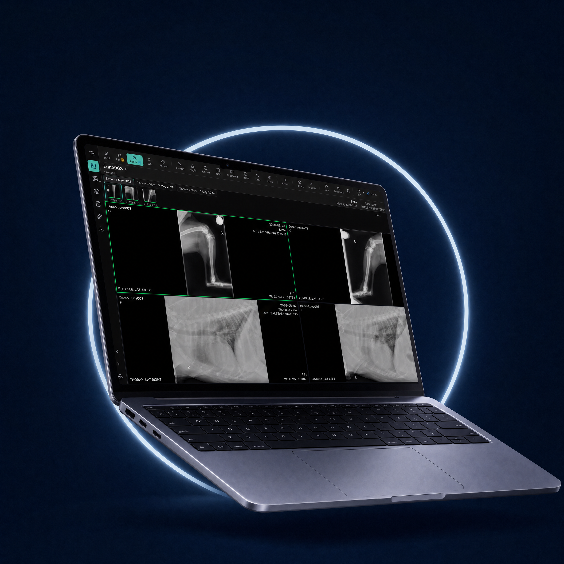 newlumen graphic