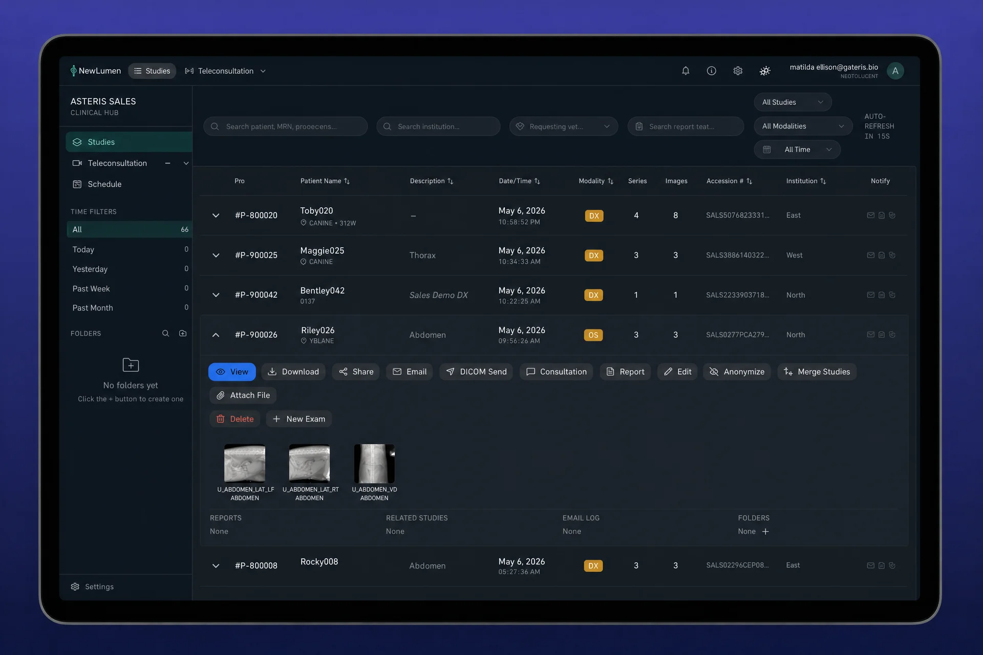 newlumen ui 5